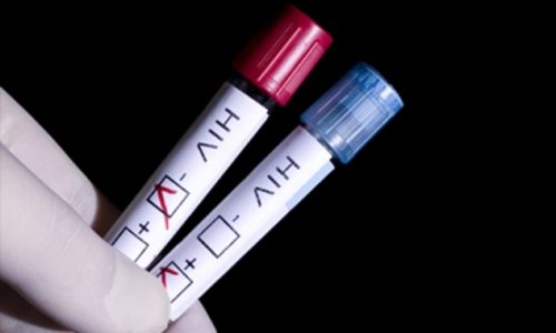 336164_hiv-tes-topnews-ae_f